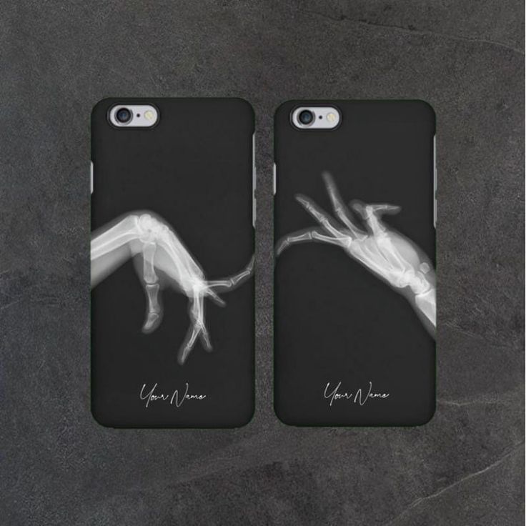 Love Birds Duo Case ( For All Smart Phones )👩‍❤️‍👨